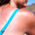 Two Types of Skin Cancer Are Skyrocketingâ€”Are You At Risk?