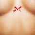 5 Breast Cancer Myths You Hear All the Time That Just Aren't True