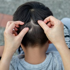 Mother is catching hair to find lice and treatment hair in children.