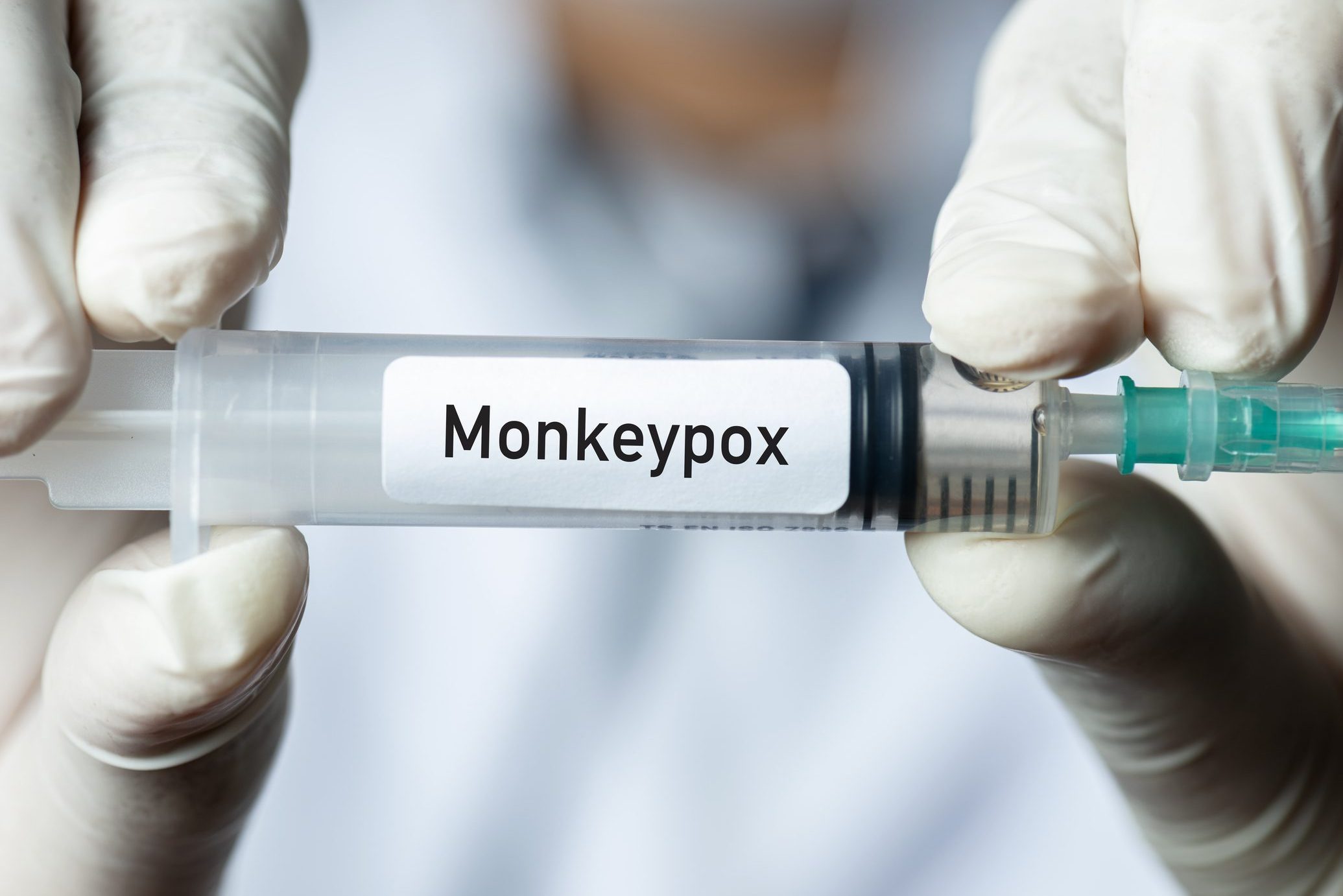 Monkeypox Symptoms and 7 Other Facts from Epidemiologists