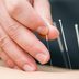 Acupuncture to This Surprising Body Part May Help You Lose Weight, Says New Study